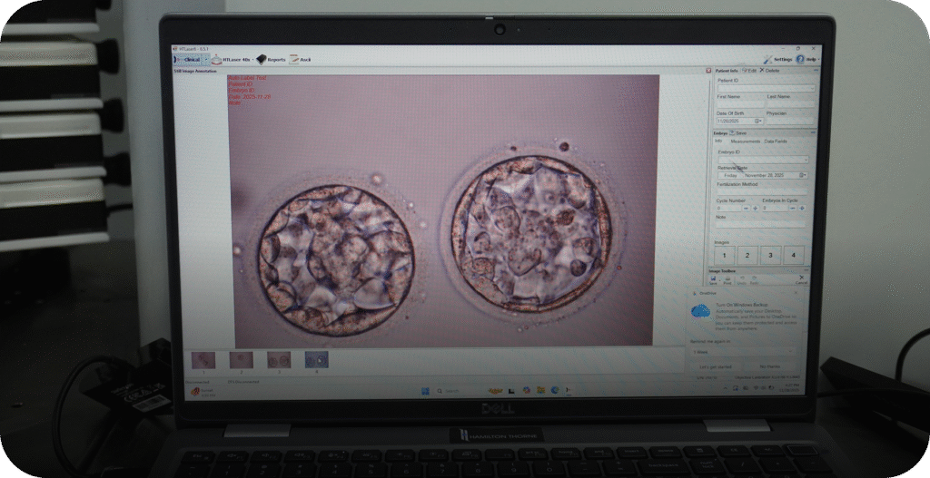 Close-up view of a laptop screen displaying two high-quality blastocyst embryos in the IVF lab. - AAS Fertility