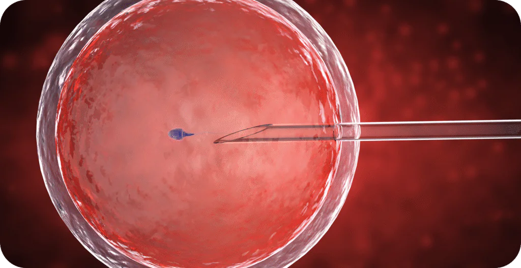 IUI Treatment Process: Complete Guide to Steps and Costs - AAS Fertility & IVF Center