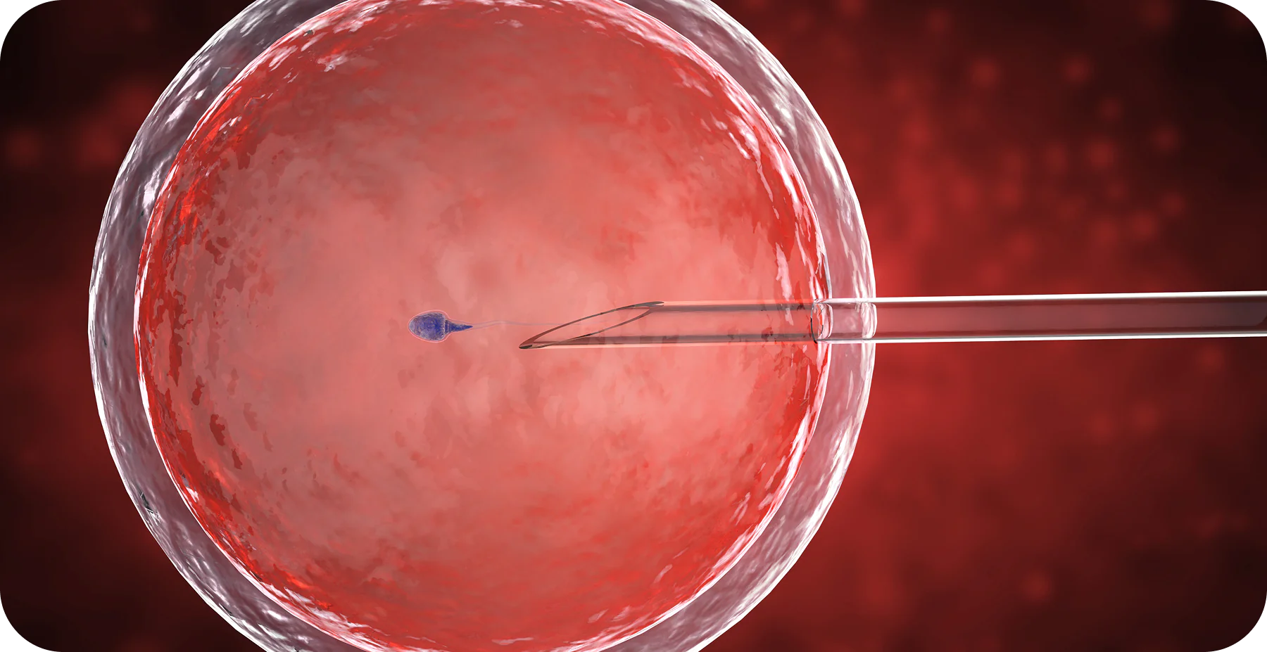 IUI Treatment Process: Complete Guide to Steps and Costs - AAS Fertility & IVF Center